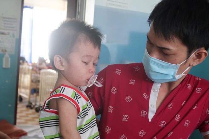 Sởi bùng phát tại TPHCM: Người lớn, trẻ nhỏ ùn ùn nhập viện - ảnh 3