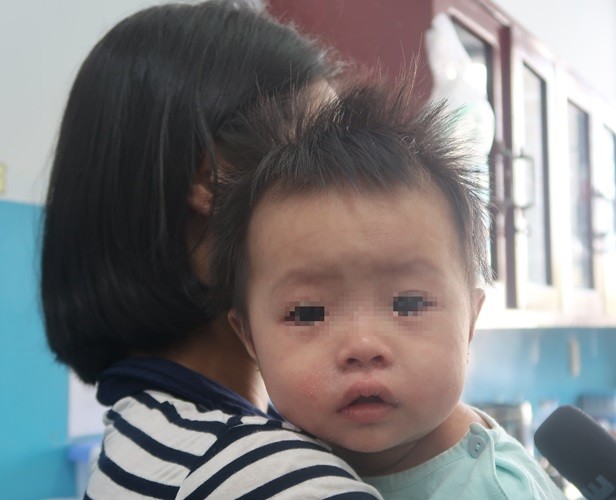 Sởi bùng phát tại TPHCM: Người lớn, trẻ nhỏ ùn ùn nhập viện - ảnh 5