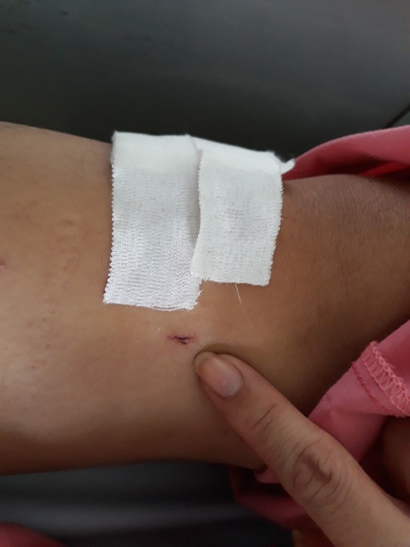 Phát ngôn chính thức của Bệnh viện Chợ Rẫy về vụ việc khoan nhầm bệnh nhân - ảnh 1