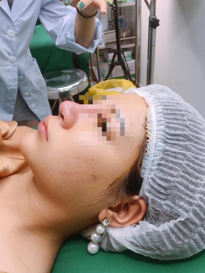 Người phụ nữ nguy kịch nghi sốc phản vệ khi gây mê nâng mũi - ảnh 1