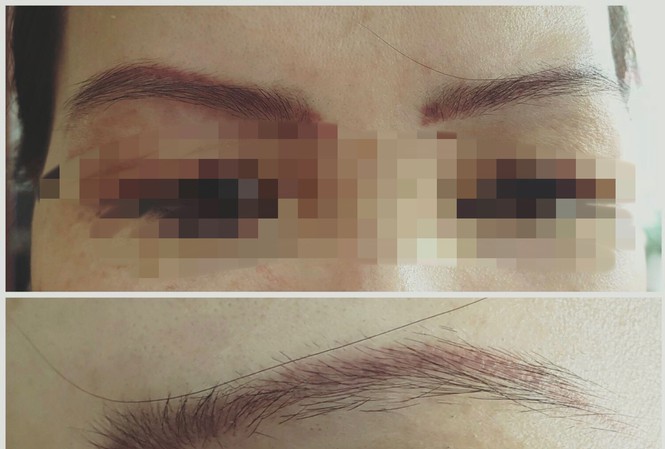 Điểm mặt những tai biến thẩm mỹ rúng động ở Sài Gòn - ảnh 3