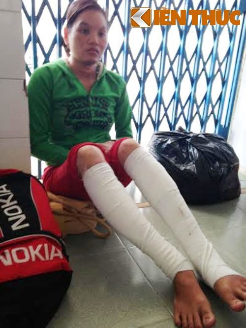 Hai mẹ con bỏng nặng vì bị ném 'bom' xăng - ảnh 1