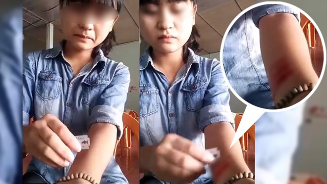 Người trẻ ngược đãi bản thân - ảnh 2