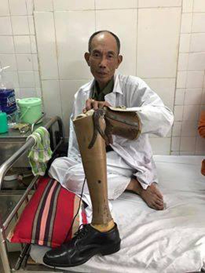 Vụ cựu binh bị đánh: Công an tiếp nhận đơn đề nghị khởi tố vụ án - ảnh 1