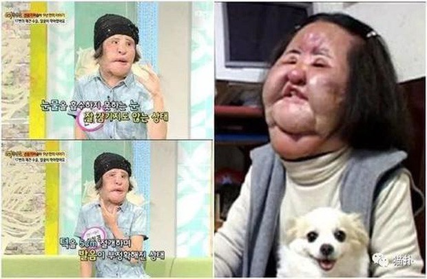 Bi kịch ‘thảm họa thẩm mỹ’ Hàn Quốc: Từ mỹ nhân hóa 'quái vật' - ảnh 4