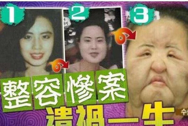 Bi kịch ‘thảm họa thẩm mỹ’ Hàn Quốc: Từ mỹ nhân hóa 'quái vật' - ảnh 3