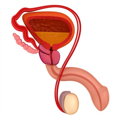 Đàn ông nóng nảy, cộc cằn, cáu gắt, khó đi tiểu… mắc bệnh gì? - ảnh 1