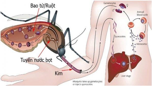 Đừng nhầm sốt xuất huyết với các bệnh gây sốt! - ảnh 1