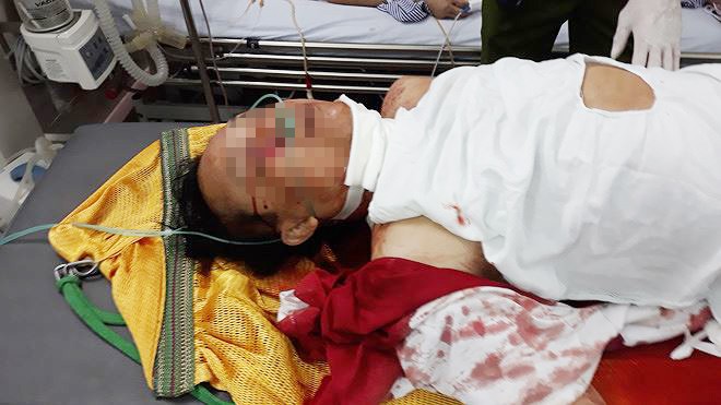 Thảm án 5 người thương vong: Hung thủ có dấu hiệu hoang tưởng? - ảnh 2