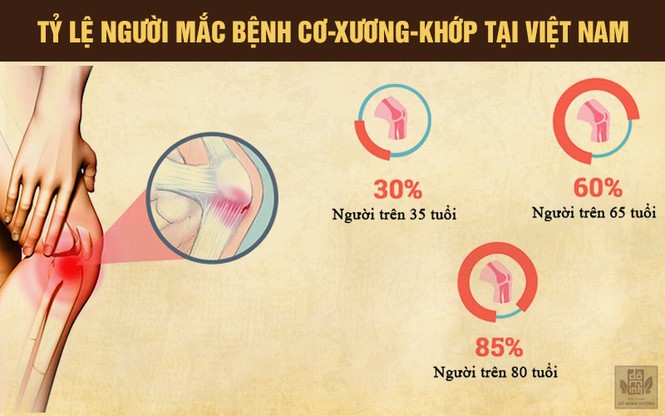 Nhà thuốc nam Đỗ Minh Đường: Nơi giúp NS Xuân Hinh chữa khỏi bệnh xương khớp - ảnh 2