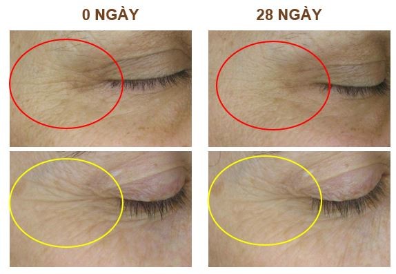 AH8 - Thành tựu đạt giải thưởng Nobel lần đầu tiên ứng dụng trong sản phẩm Việt - ảnh 2