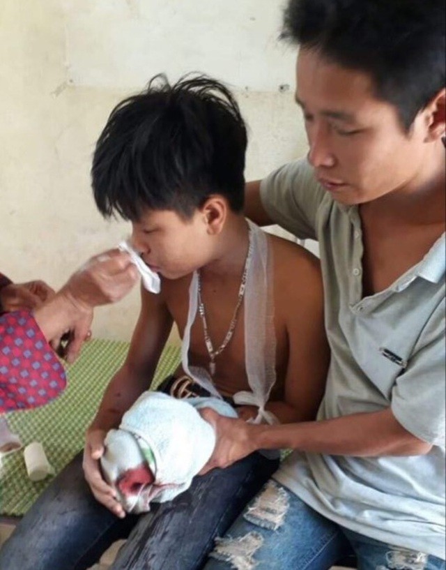 Máy tính xách tay phát nổ, 3 học sinh bị thương nặng - ảnh 1