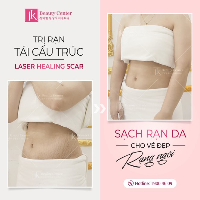 Phòng khám chuyên khoa thẩm mỹ JK độc quyền công nghệ trị rạn tái cấu trúc Healing Scar - ảnh 5