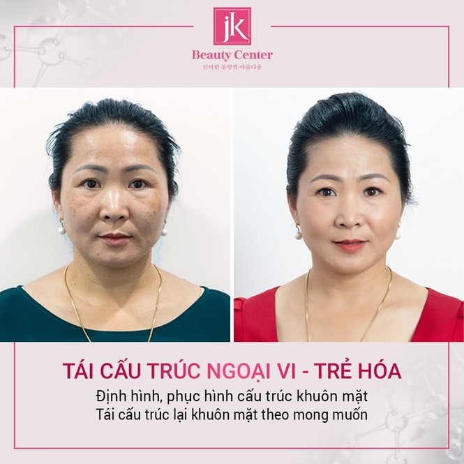 Bí quyết trẻ trung, xinh đẹp như thời thanh xuân của nữ diễn viên Thu Hương - ảnh 10