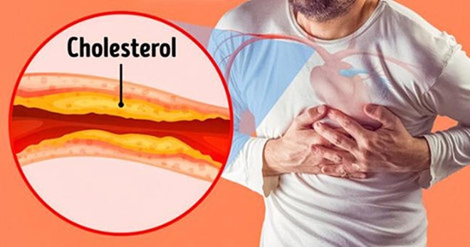 Vì sao Nattokinase Jintan hỗ trợ ‘hạ mỡ máu, ngăn tai biến’ hiệu quả - ảnh 1