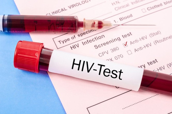 Gần 66% số ca nhiễm HIV do nguyên nhân này - ảnh 1