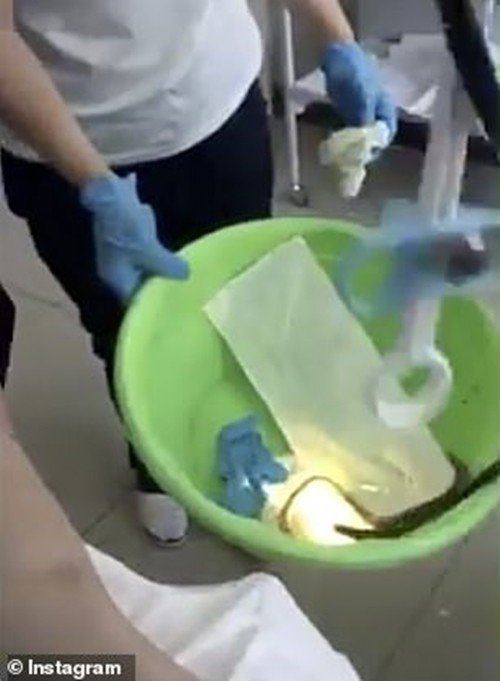 Kinh hoàng với video con rắn dài 121cm được lôi từ họng bệnh nhân ra, nó bò vào lúc nào vậy? - ảnh 3