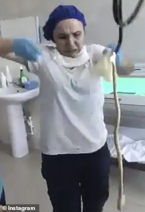 Kinh hoàng với video con rắn dài 121cm được lôi từ họng bệnh nhân ra, nó bò vào lúc nào vậy? - ảnh 2