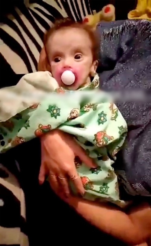 Bé gái sơ sinh bị mẹ nhét trong tủ và bỏ đói, sống sót kỳ diệu vì anh trai lén lấy đồ thừa cho ăn - ảnh 4