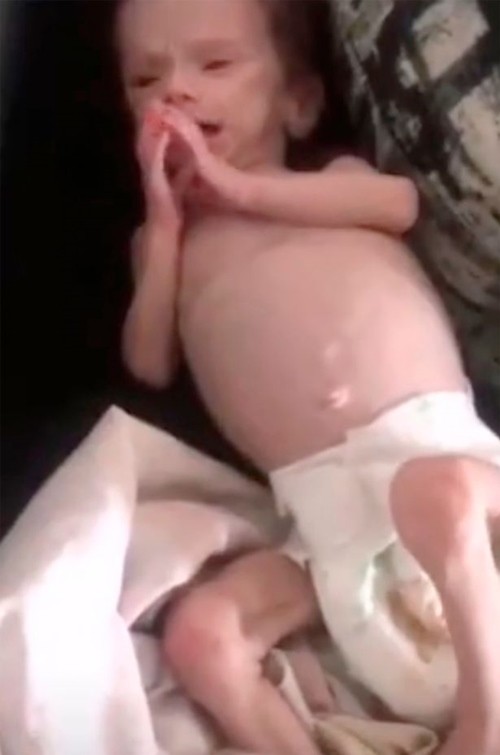 Bé gái sơ sinh bị mẹ nhét trong tủ và bỏ đói, sống sót kỳ diệu vì anh trai lén lấy đồ thừa cho ăn - ảnh 3