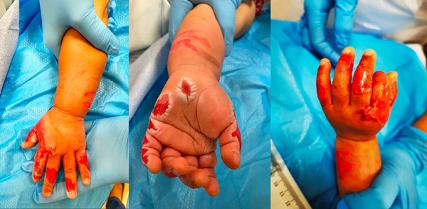 Muốn chuyển nhà không được, người giúp việc ấn tay con gái 14 tháng tuổi của chủ vào nước sôi - ảnh 3
