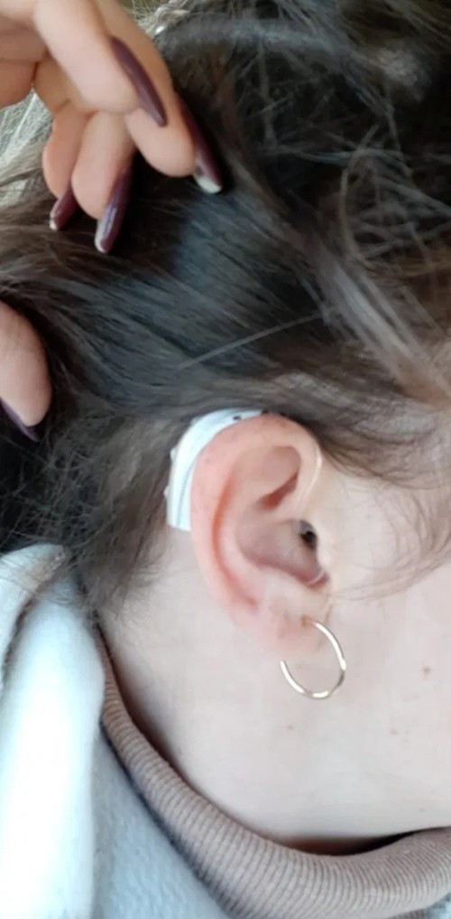 Cứ tưởng dầu gội chảy vào làm đau tai, nhưng cô gái này bỗng nhiên không nghe thấy gì nữa - ảnh 1