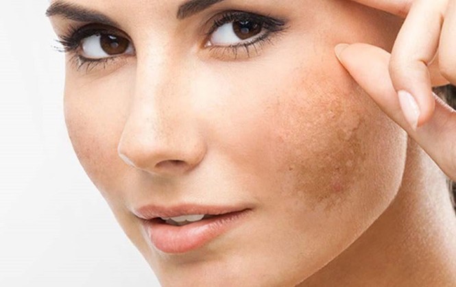 Những thói quen tưởng chẳng có hại gì mấy, lại có thể khiến da mặt bạn xấu đi - ảnh 1