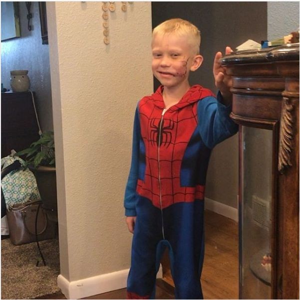 “Người Nhện” Tom Holland mời cậu bé bị chó cắn để cứu em đến phim trường “Spider-Man 3” - ảnh 2