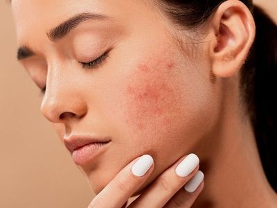 Tẩy tế bào chết vật lý & hóa học, chọn cách nào để
