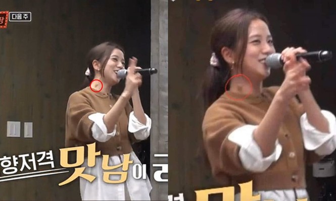 Jisoo (BLACKPINK) nổi hạch lớn ở cổ, bệnh cũ tái phát do phải làm việc đến kiệt sức? - ảnh 1