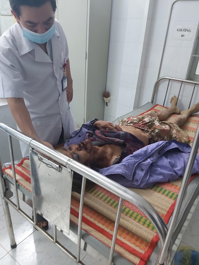 Một người dân nghi bị voi rừng tấn công nguy kịch - ảnh 1
