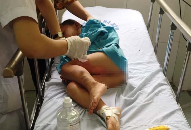 3 trẻ bị bỏng học kỹ năng kêu cứu và thoát hiểm, không phải học chống cháy nổ - ảnh 1