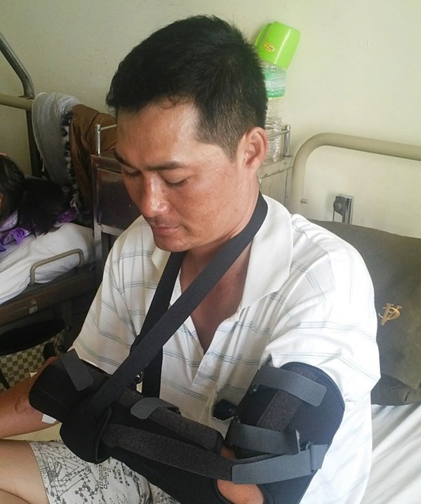 Đuổi cướp, thiếu úy công an bị chém - ảnh 1