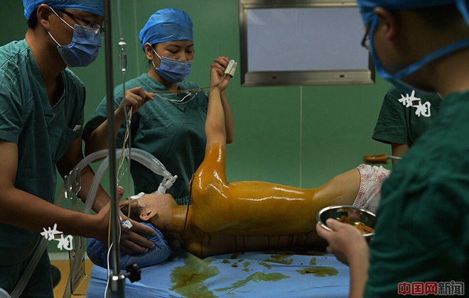 Tận thấy ca phẫu thuật nâng ngực của người mẫu Trung Quốc - ảnh 5