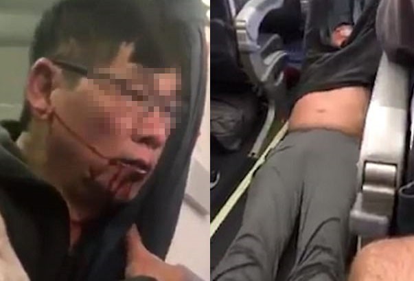 Vụ David Dao chưa dứt, United Airlines lại bị tố ép cụ bà 94 - ảnh 1