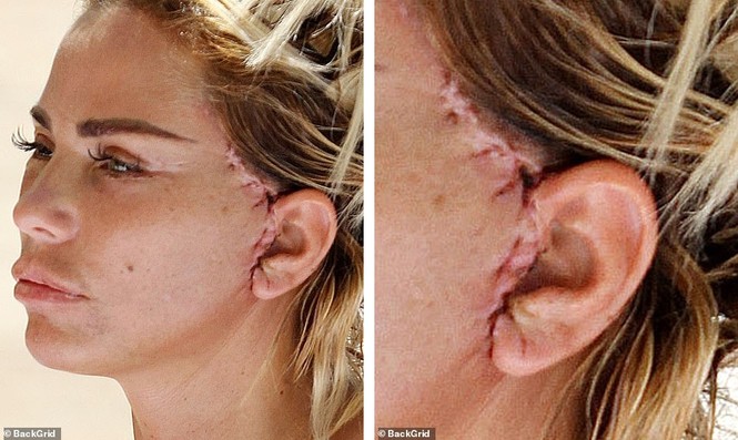 Katie Price để ngực trần còn nguyên vết phẫu thuật đi bơi gây sốc - ảnh 3