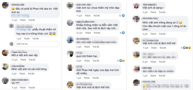 Dân mạng lại 'mắt tròn mắt dẹt' vì mũi dài khác lạ của Việt Anh - ảnh 2
