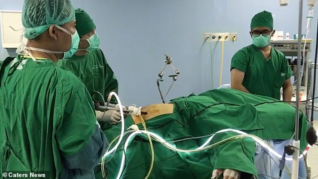 Đứa trẻ béo nhất thế giới với 190kg giảm cân ngoạn mục - ảnh 4
