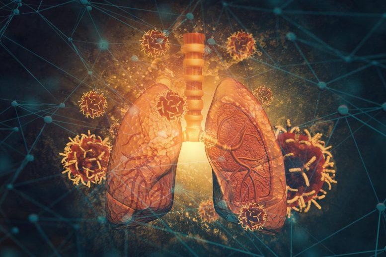 Các nhà nghiên cứu lập bản đồ tế bào của phổi để tìm ra cơ chế hoạt động và gây chết người của nó cũng như tìm ra thuốc đặc trị.