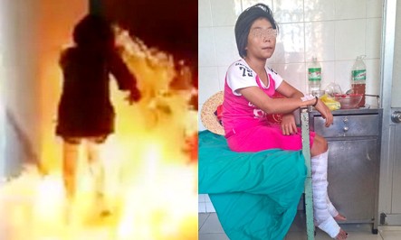 Ngọc Hân lúc phóng hỏa và được gia đình đưa tới bệnh viện ở thị xã Ninh Hòa để điều trị