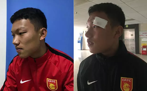 Cầu thủ Hà Nội đấm vào mặt đối thủ người Trung Quốc