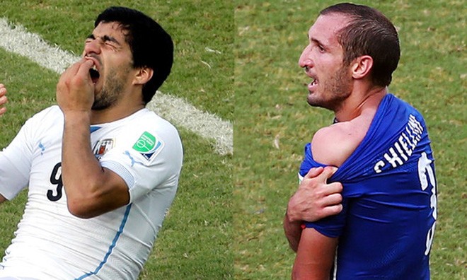 Luis Suarez lại cắn người: Vì anh là ‘ác thú’