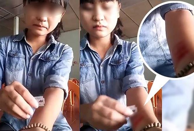Cô gái ở Nghệ An cắt tay ngay sau khi chia tay người yêu.