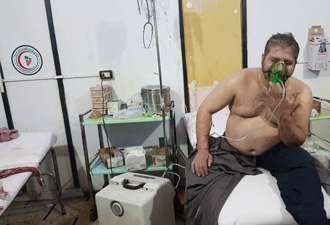 Một người Syria được báo chí phương Tây chú thích là nạn nhân vụ tấn công hóa học tối 7/4 đang được điều trị. Ảnh: Getty Images.