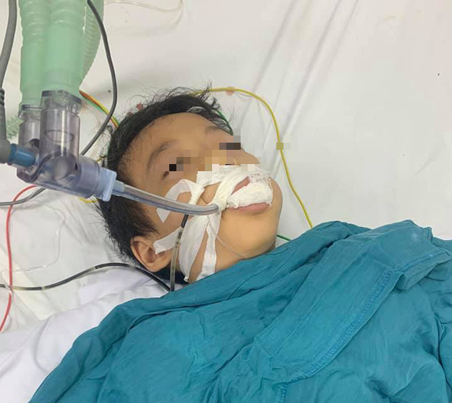 Hải Phòng: Bé trai 6 tuổi nguy kịch vì ăn nhầm thuốc diệt chuột