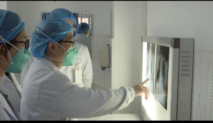  Bác sĩ kiểm tra phim X-quang bệnh nhân viêm phổi ở Vũ Hán. Ảnh: Xinhua.