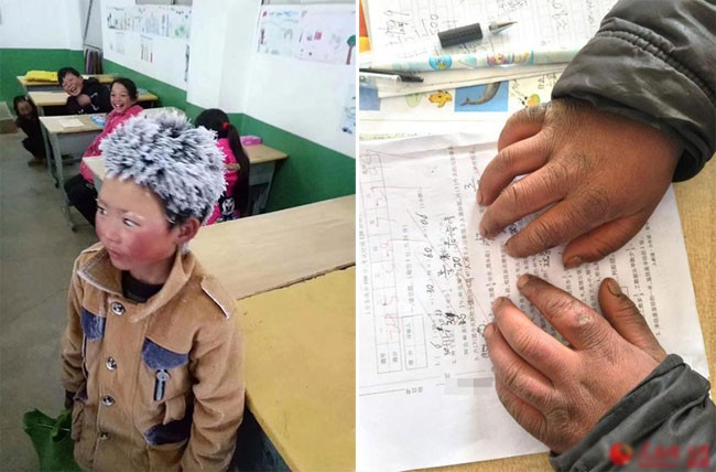Mái tóc đóng băng trắng xóa và bàn tay nứt nẻ, đỏ ửng của một học sinh lớp 3 ở Trung Quốc sau khi đi bộ tới trường trong cái rét kỷ lục.