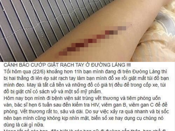 Hà Nội: Thiếu nữ tự dùng dao lam rạch tay rồi tung tin bị cướp tấn công ở đường Láng