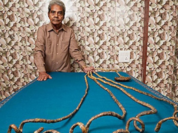 Bộ móng tay dài nhất thế giới cuối cùng đã bị cắt sau 66 năm