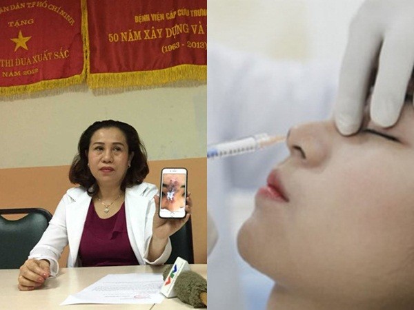 Thiếu nữ 19 tuổi hoại tử mũi vì tiêm chất làm đầy